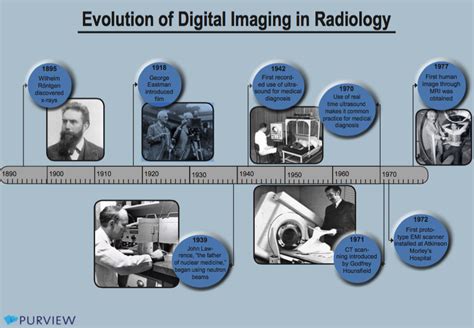  X-Ray: A History of X-rays and Their Role in Shaping Modern Medicine - Unveiling the Invisible Radiance That Transformed Healthcare